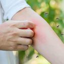 Sting Stick Bug Bite Relief Rechargeable Pen image number 3